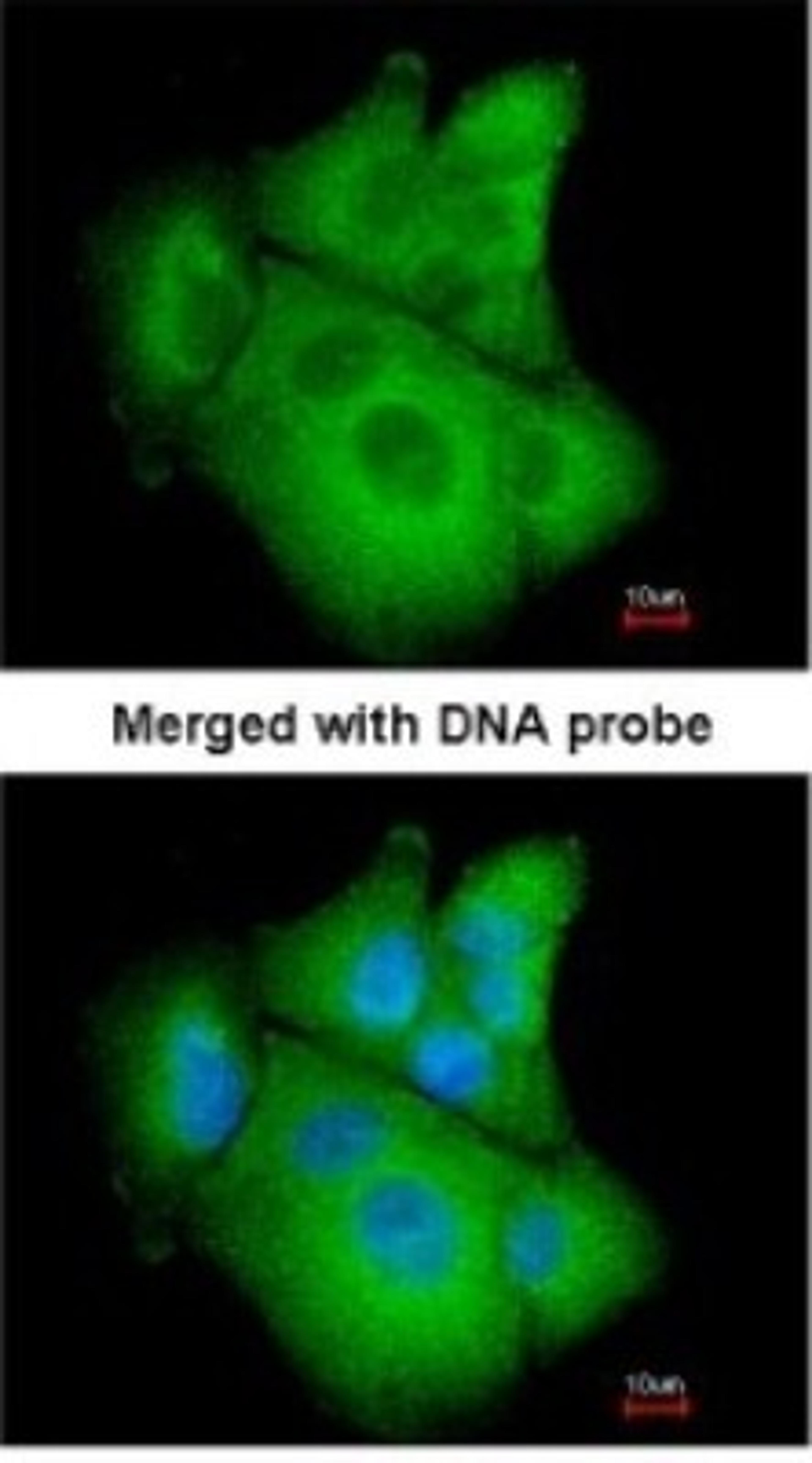 Immunocytochemistry/Immunofluorescence: PSAT1 Antibody [NBP1-32920] - Paraformaldehyde-fixed A549, using antibody at 1:200 dilution.