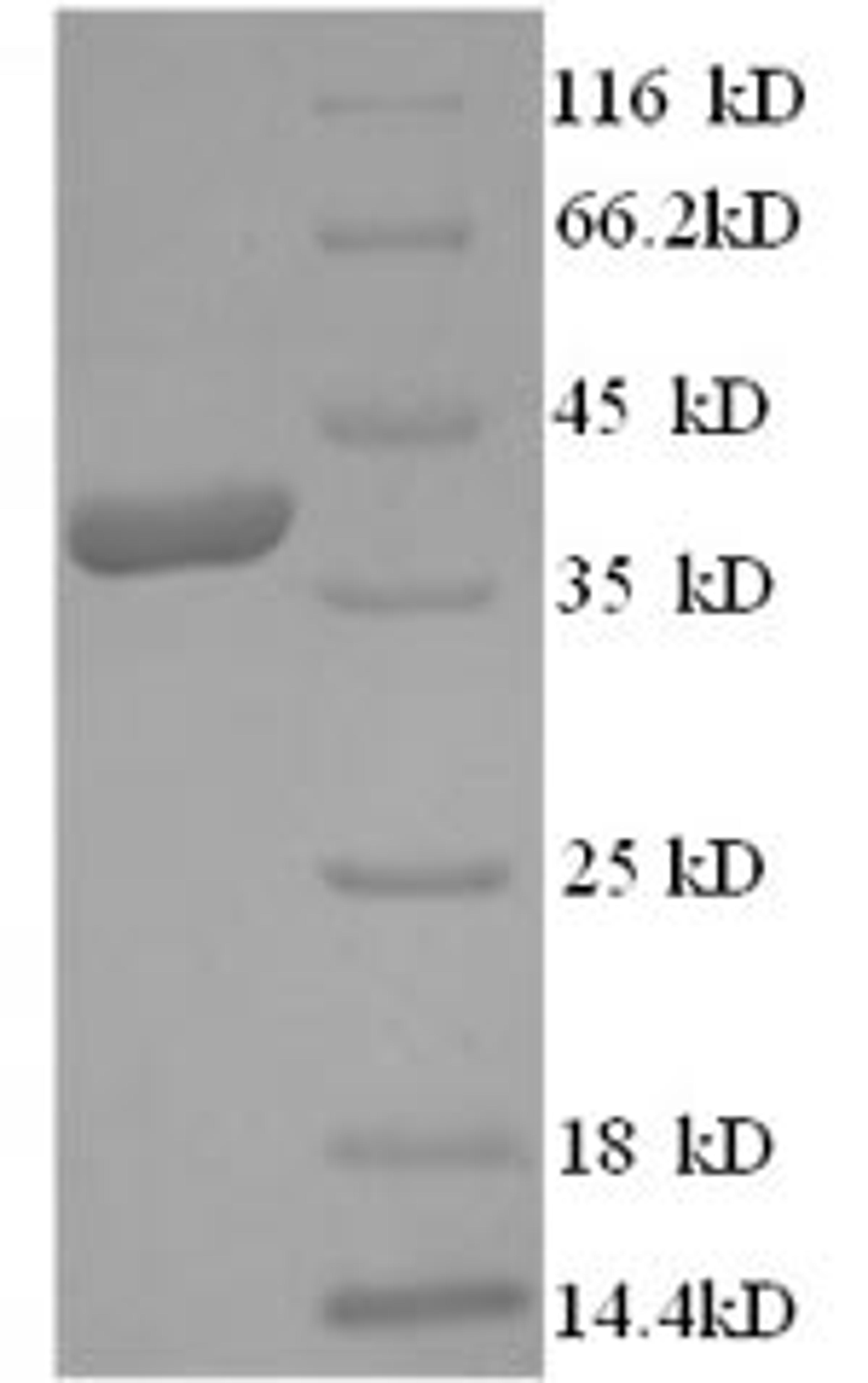 (Tris-Glycine gel) Discontinuous SDS-PAGE (reduced) with 5% enrichment gel and 15% separation gel.