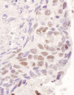 Detection of human GR by immunohistochemistry.