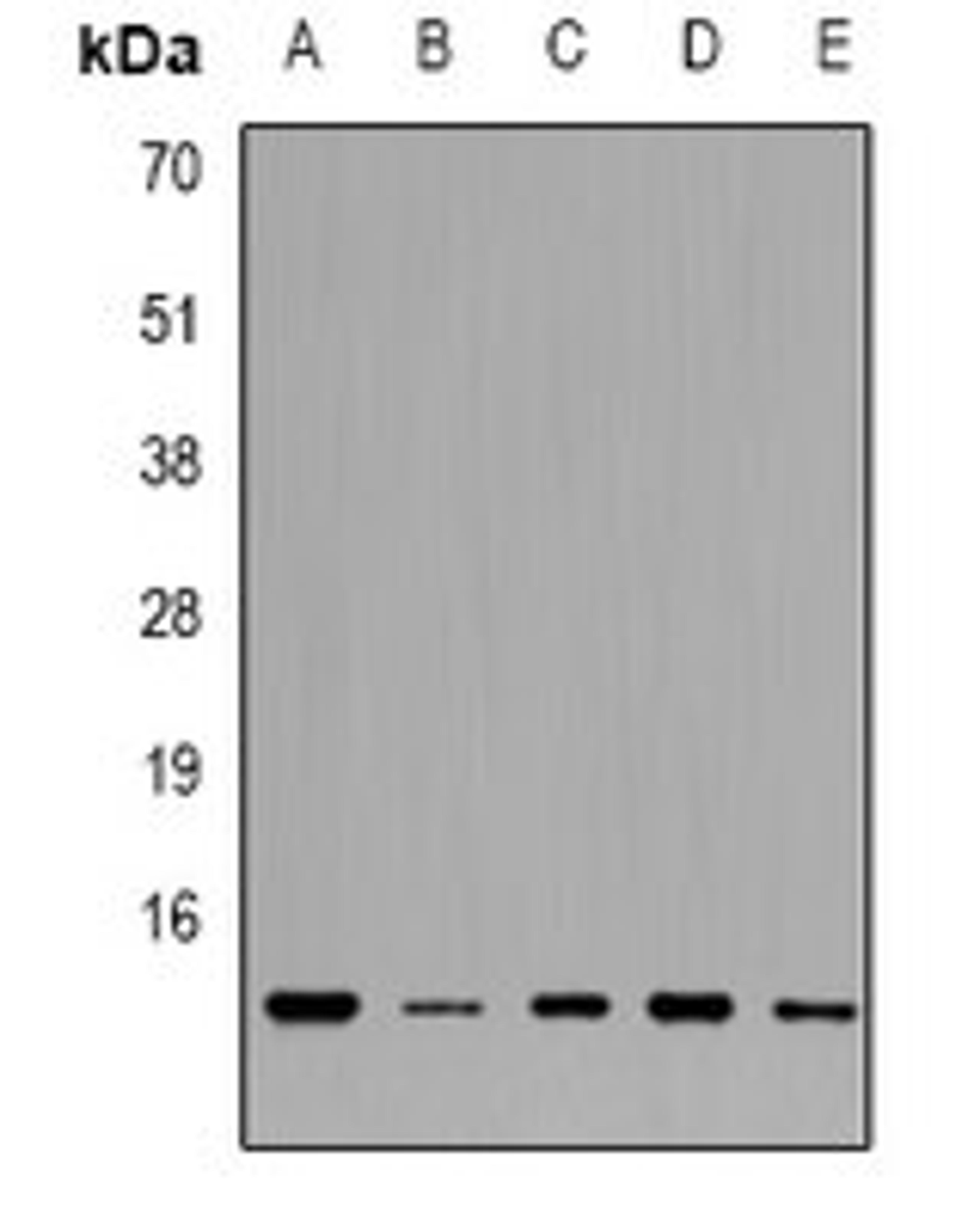 Western blot analysis of HL60 (Lane1), Raji (Lane2), K562 (Lane3), SW480 (Lane4), A549 (Lane5) whole cell lysates using TXNDC17 antibody