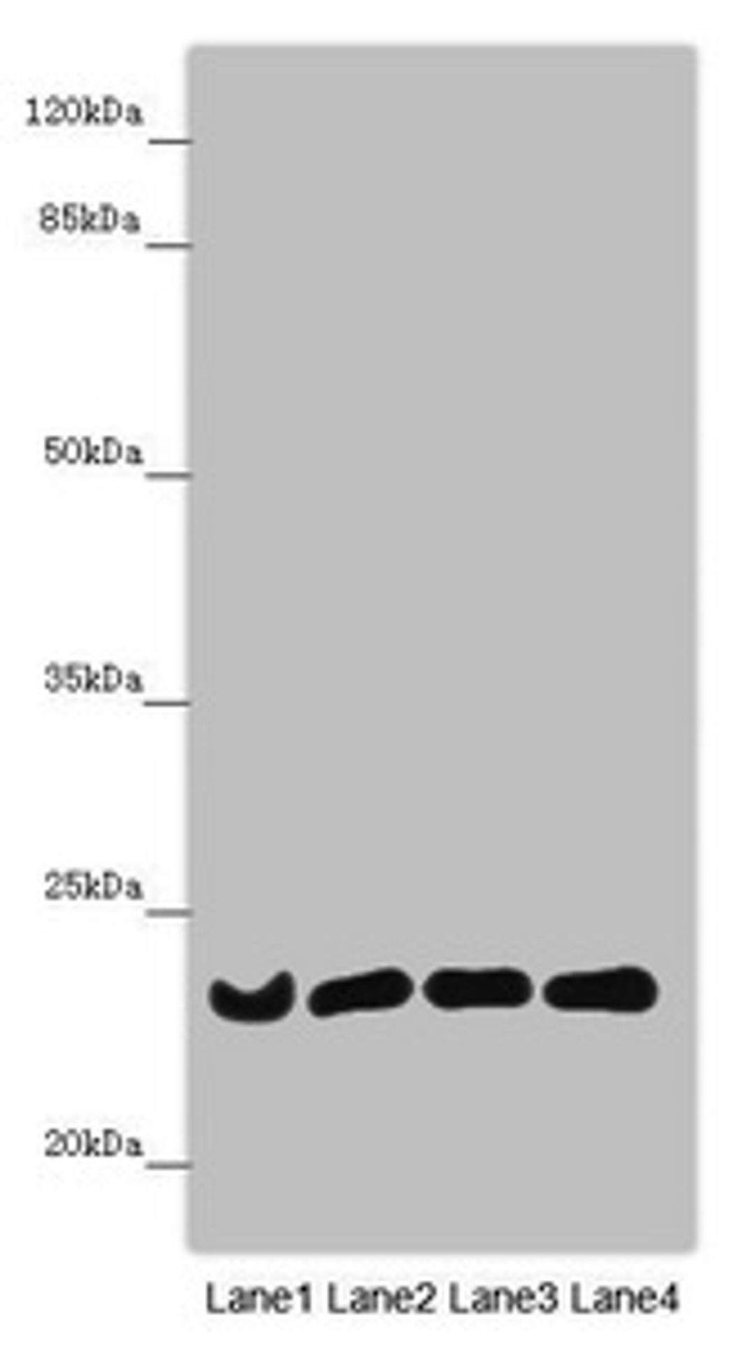 Western blot. All lanes: B9D1 antibody at 6.61µg/ml. Lane 1: Mouse lung tissue. Lane 2: Mouse gonadal tissue. Lane 3: Hela whole cell lysate. Lane 4: 293T whole cell lysate. Secondary. Goat polyclonal to rabbit IgG at 1/10000 dilution. Predicted band size: 23, 17 kDa. Observed band size: 23 kDa