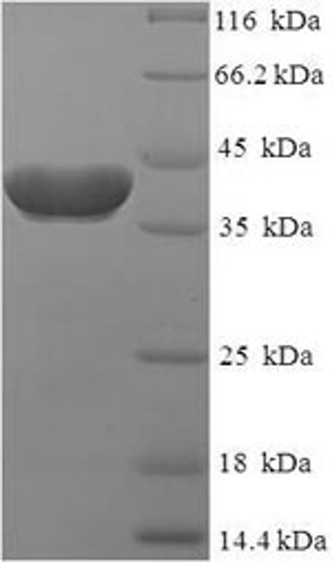 (Tris-Glycine gel) Discontinuous SDS-PAGE (reduced) with 5% enrichment gel and 15% separation gel.