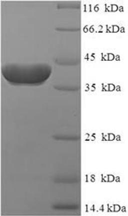 (Tris-Glycine gel) Discontinuous SDS-PAGE (reduced) with 5% enrichment gel and 15% separation gel.