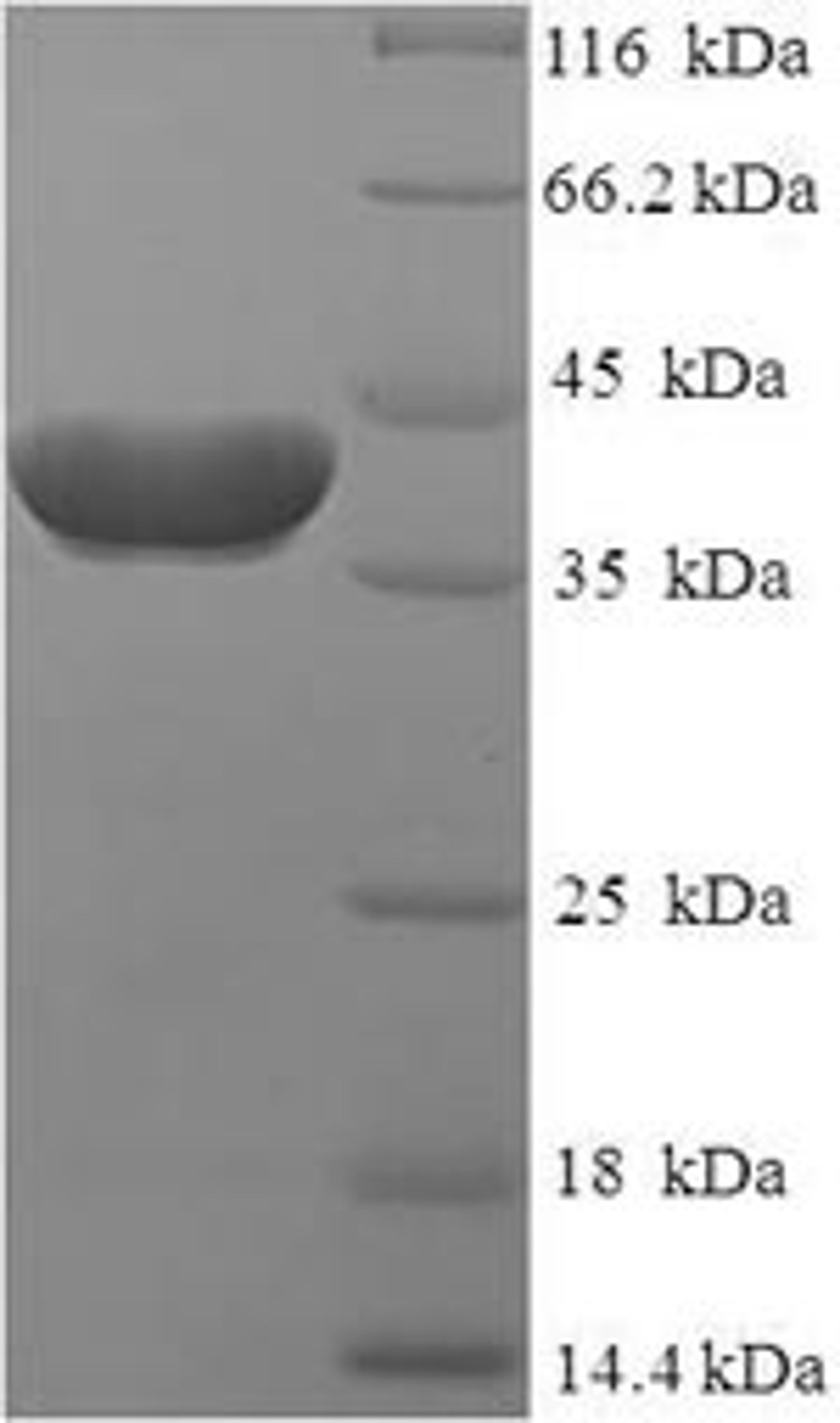 (Tris-Glycine gel) Discontinuous SDS-PAGE (reduced) with 5% enrichment gel and 15% separation gel.