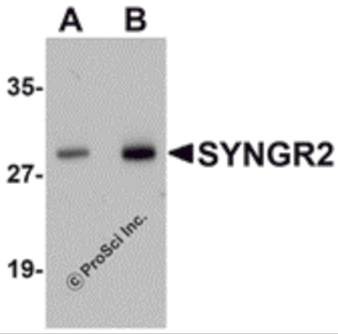 Western blot analysis of SYNGR2 in human lung tissue lysate with SYNGR2 antibody at (A) 1 and (B) 2 μg/mL.
