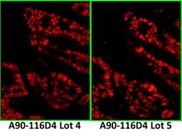 Detection of human p53 by IF.