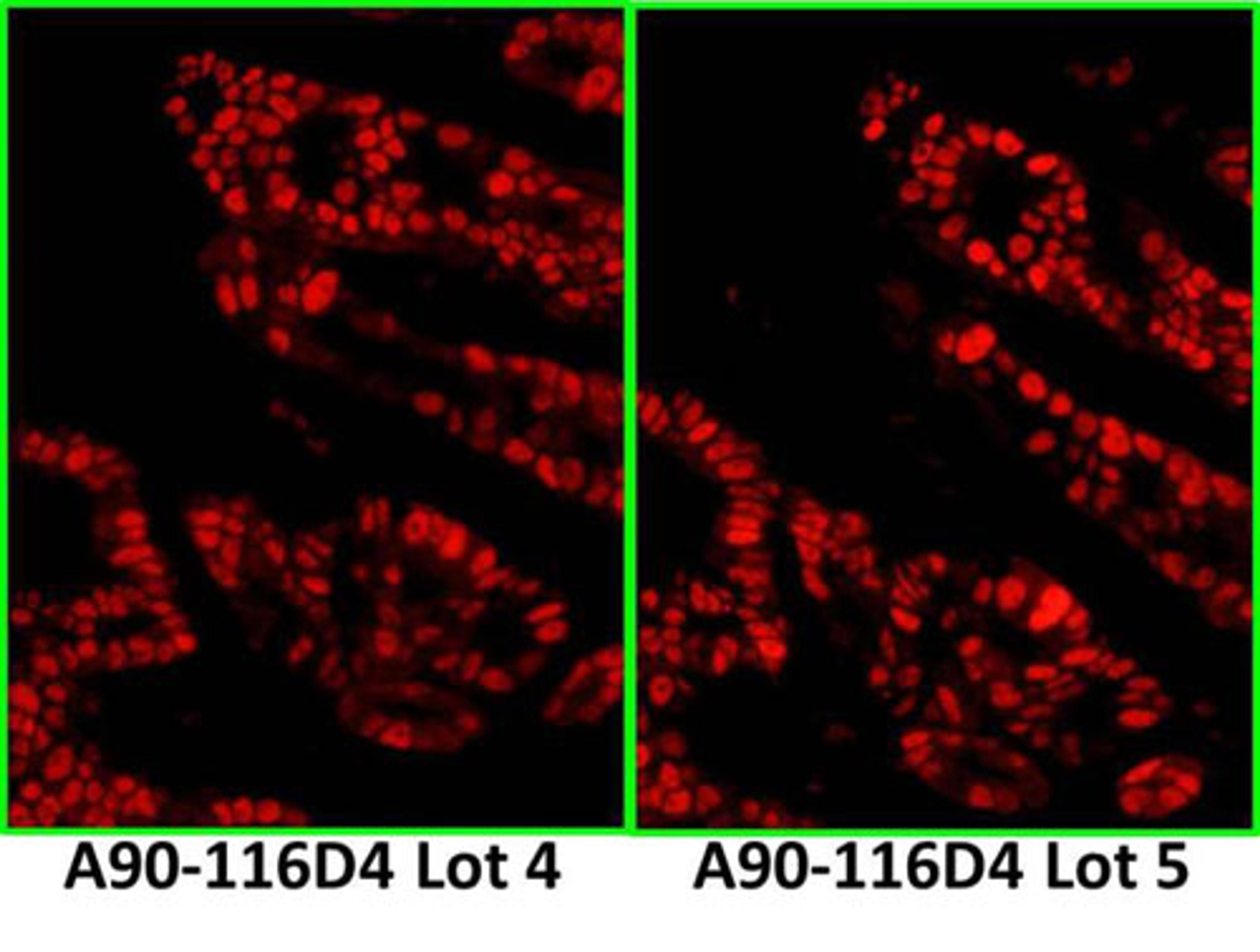 Detection of human p53 by IF.