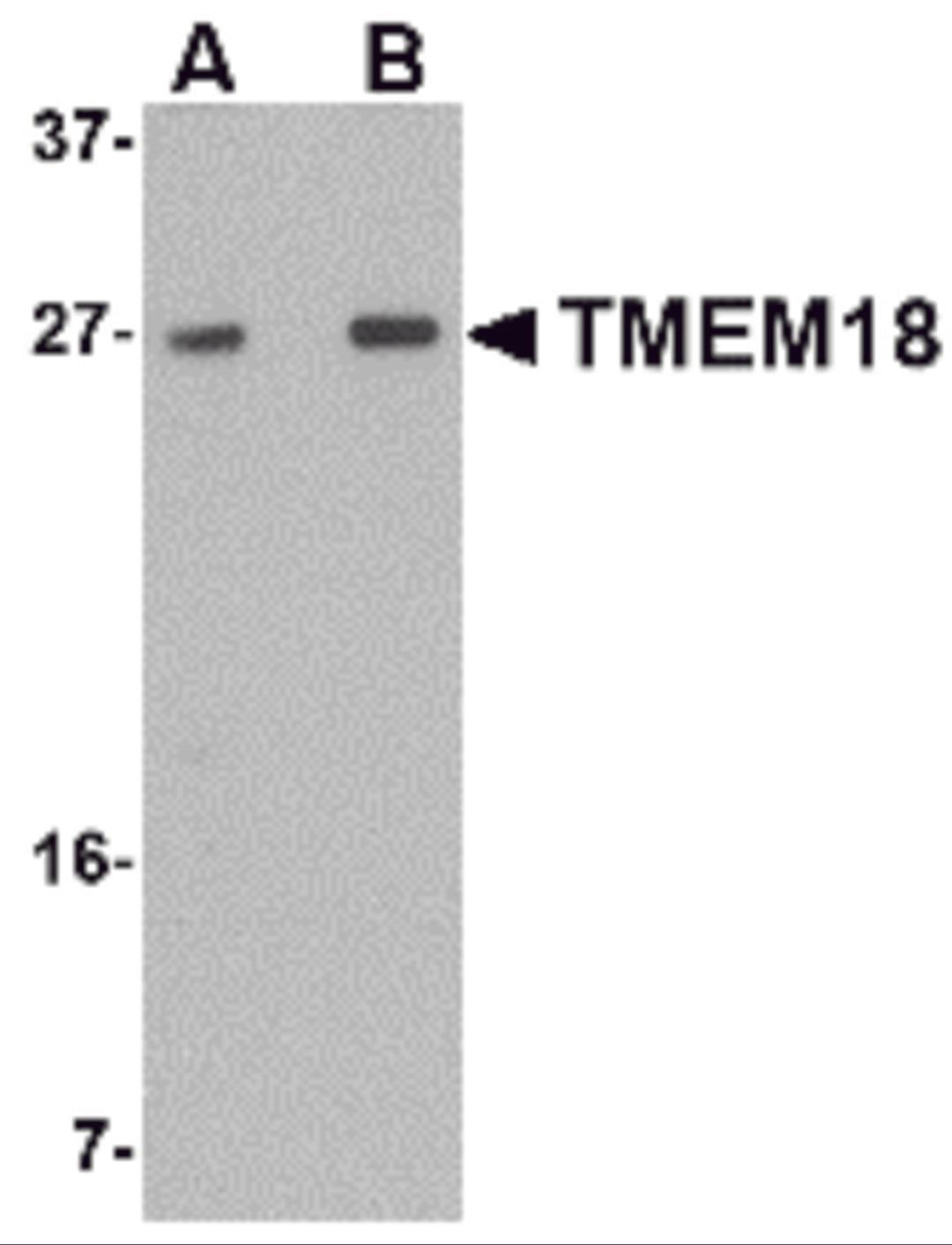Western blot analysis of TMEM18 in rat brain lysate with TMEM18 antibody at (A) 0.5 and (B) 1 μg/mL.