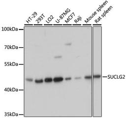 Western blot - SUCLG2 antibody (A8976)