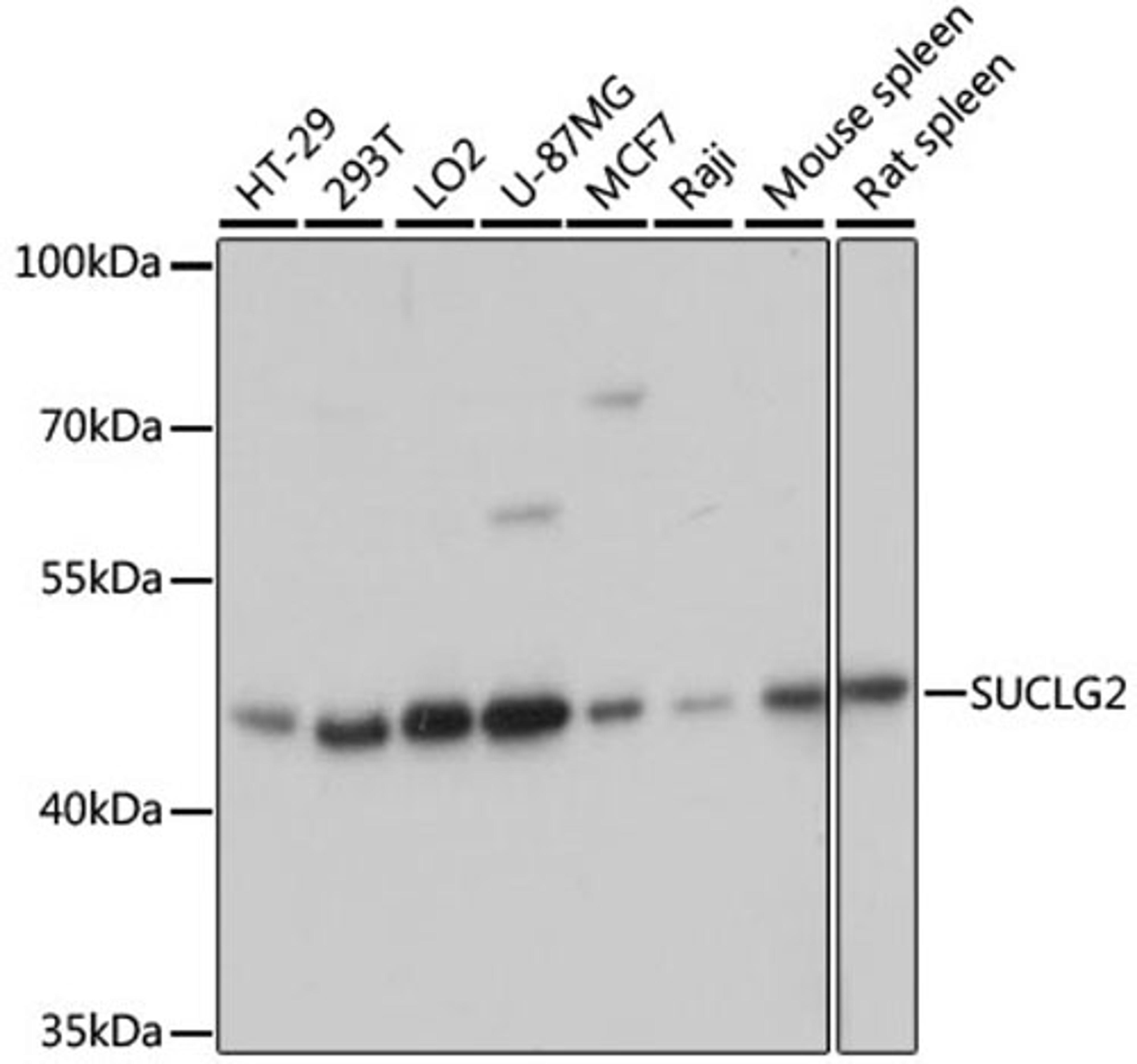 Western blot - SUCLG2 antibody (A8976)