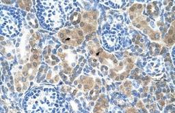 Immunohistochemistry-Paraffin: CBS Antibody [NBP1-52850] - Human Kidney tissue, Epithelial cells of renal tubule (Indicated with Arrows) 4-8 ug/ml.