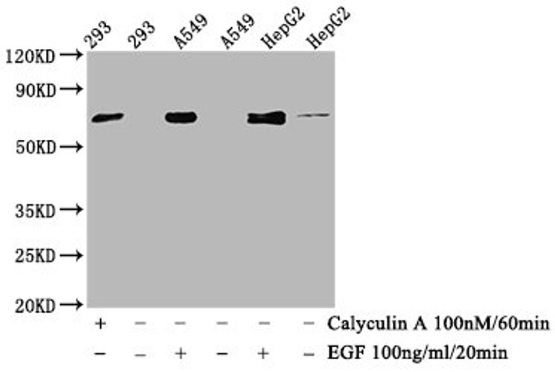 Western Blot. Positive WB detected in 293 whole cell lysate,A549 whole cell lysate,HepG2 whole cell lysate(treated with Calyculin A or EGF). All lanes Phospho-ATF2 antibody at 1.015μg/ml. Secondary. Goat polyclonal to rabbit IgG at 1/50000 dilution. Predicted band size: 70 KDa. Observed band size: 70 KDa.