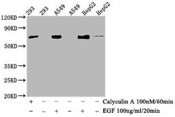 Western Blot. Positive WB detected in 293 whole cell lysate,A549 whole cell lysate,HepG2 whole cell lysate(treated with Calyculin A or EGF). All lanes Phospho-ATF2 antibody at 1.015μg/ml. Secondary. Goat polyclonal to rabbit IgG at 1/50000 dilution. Predicted band size: 70 KDa. Observed band size: 70 KDa.