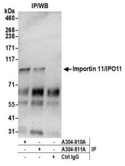 Detection of human Importin 11/IPO11 by western blot of immunoprecipitates.