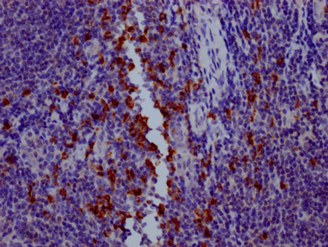 IHC image of CSB-RA794900A0HU diluted at 1:100 and staining in paraffin-embedded human tonsil tissue performed on a Leica BondTM system. After dewaxing and hydration, antigen retrieval was mediated by high pressure in a citrate buffer (pH 6.0). Section was blocked with 10% normal goat serum 30min at RT. Then primary antibody (1% BSA) was incubated at 4℃ overnight. The primary is detected by a Goat anti-rabbit IgG polymer labeled by HRP and visualized using 0.05% DAB.