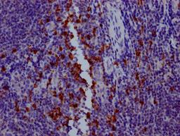 IHC image of CSB-RA794900A0HU diluted at 1:100 and staining in paraffin-embedded human tonsil tissue performed on a Leica BondTM system. After dewaxing and hydration, antigen retrieval was mediated by high pressure in a citrate buffer (pH 6.0). Section was blocked with 10% normal goat serum 30min at RT. Then primary antibody (1% BSA) was incubated at 4℃ overnight. The primary is detected by a Goat anti-rabbit IgG polymer labeled by HRP and visualized using 0.05% DAB.