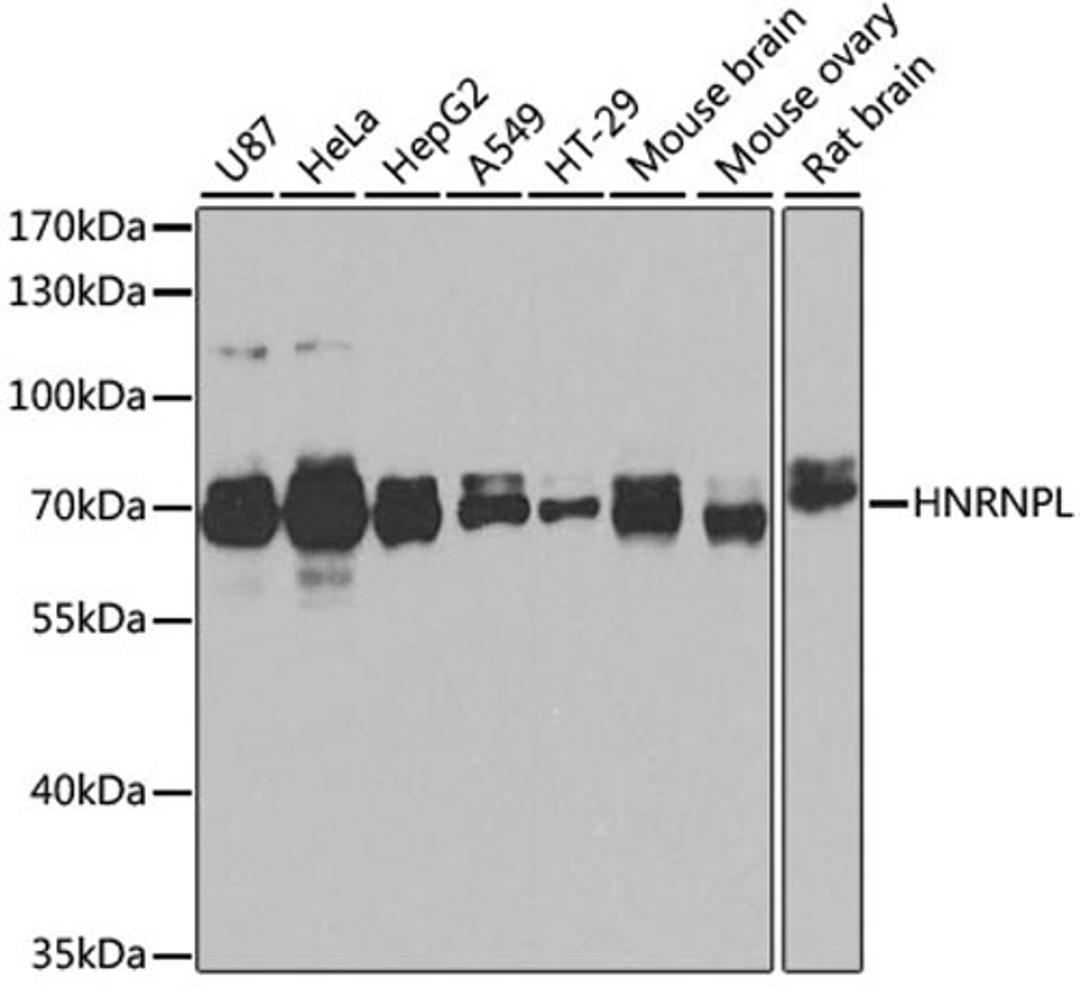 Western blot - HNRNPL antibody (A12447)