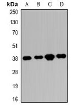 Western blot analysis of K562 (Lane1), HEK293T (Lane2), SHSY5Y (Lane3), mouse eye (Lane4) whole cell lysates using RRP7A antibody