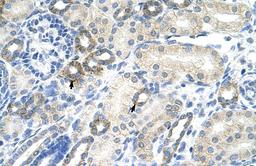 Antibody used in IHC on Human kidney.