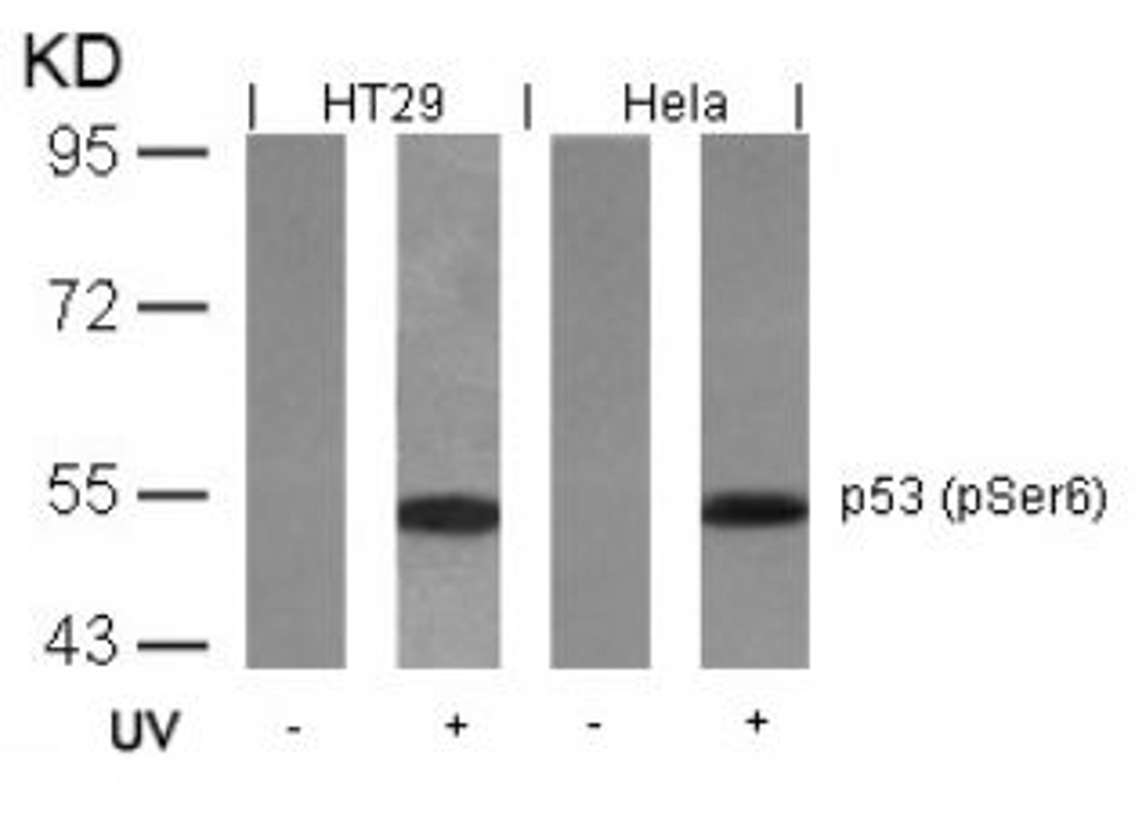 Western blot analysis of lysed extracts from HT29 and HeLa cells untreated or treated with UV using p53 (Phospho-Ser6).