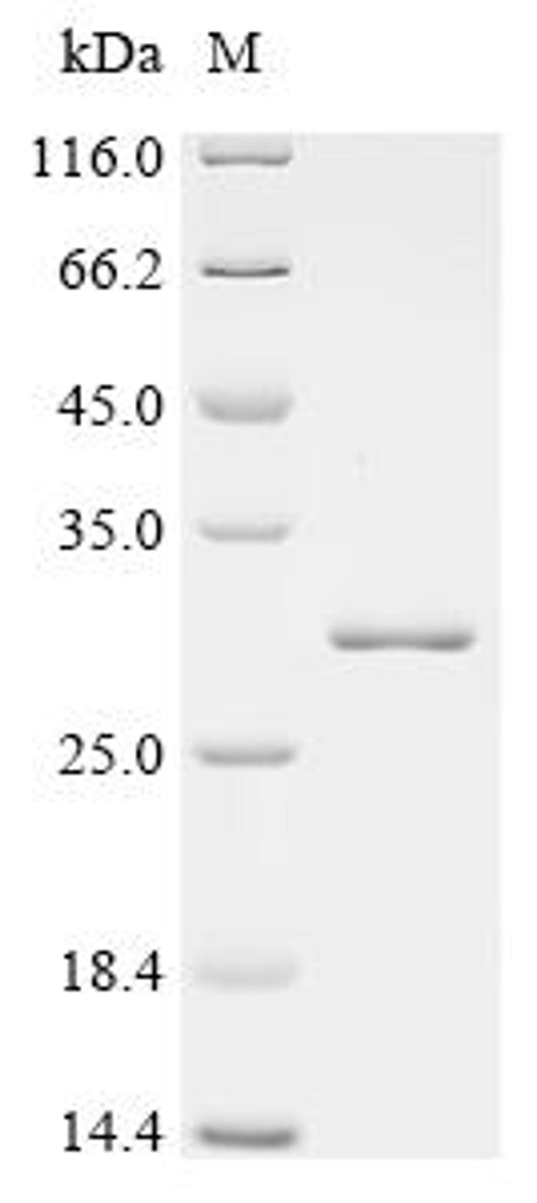 (Tris-Glycine gel) Discontinuous SDS-PAGE (reduced) with 5% enrichment gel and 15% separation gel.
