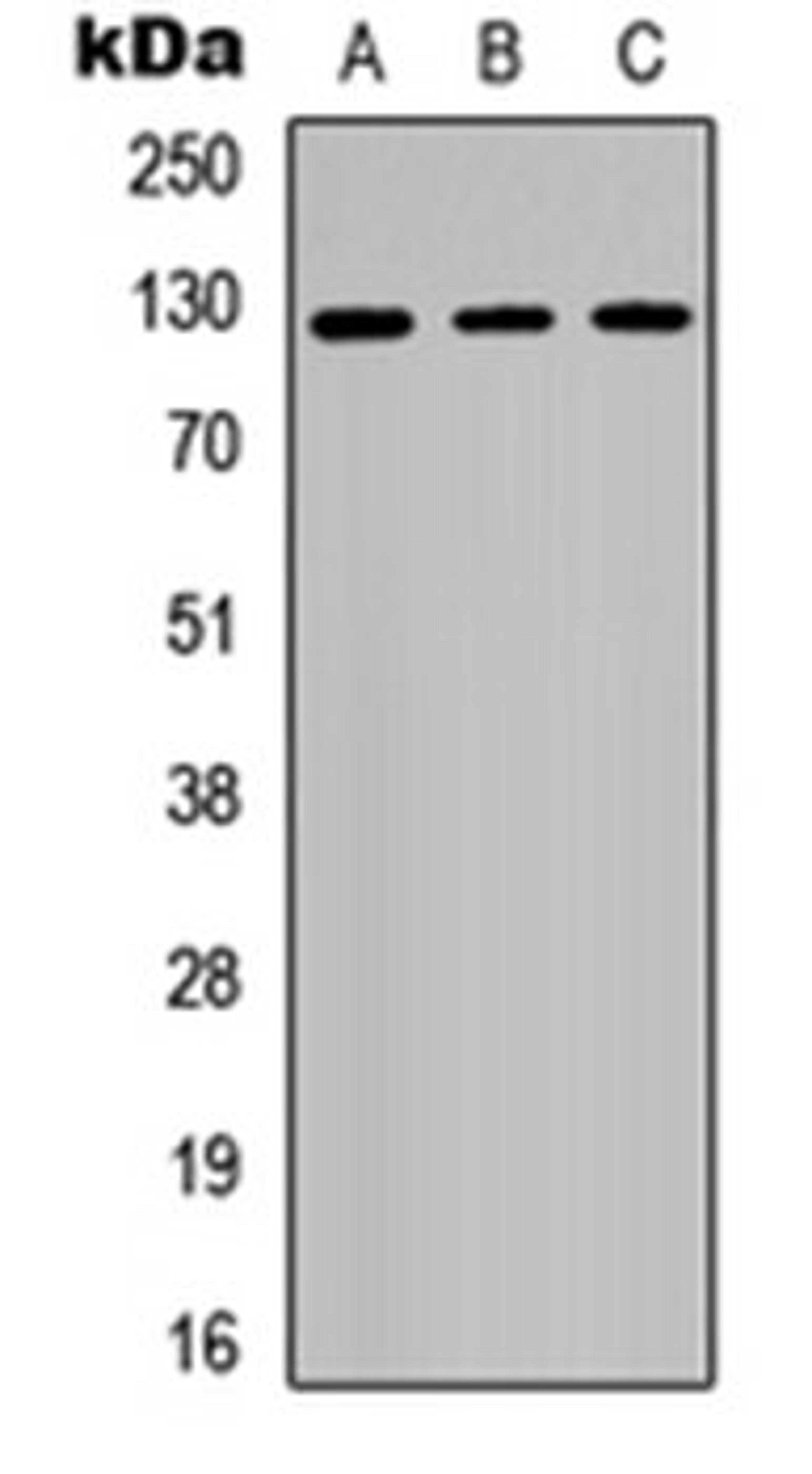 Western blot analysis of Jurkat (Lane 1), NIH3T3 (Lane 2), PC12 (Lane 3) whole cell lysates using RB2 antibody