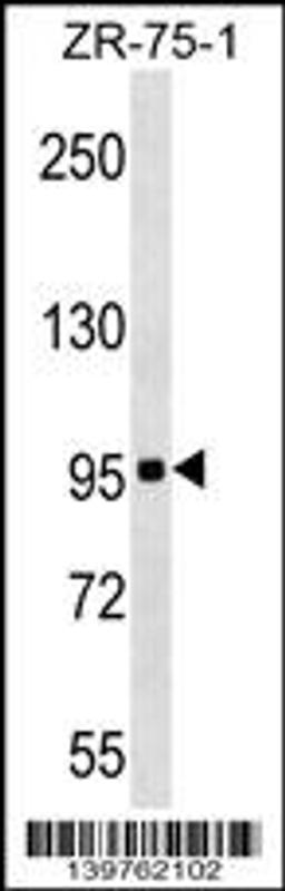 Western blot analysis in ZR-75-1 cell line lysates (35ug/lane).