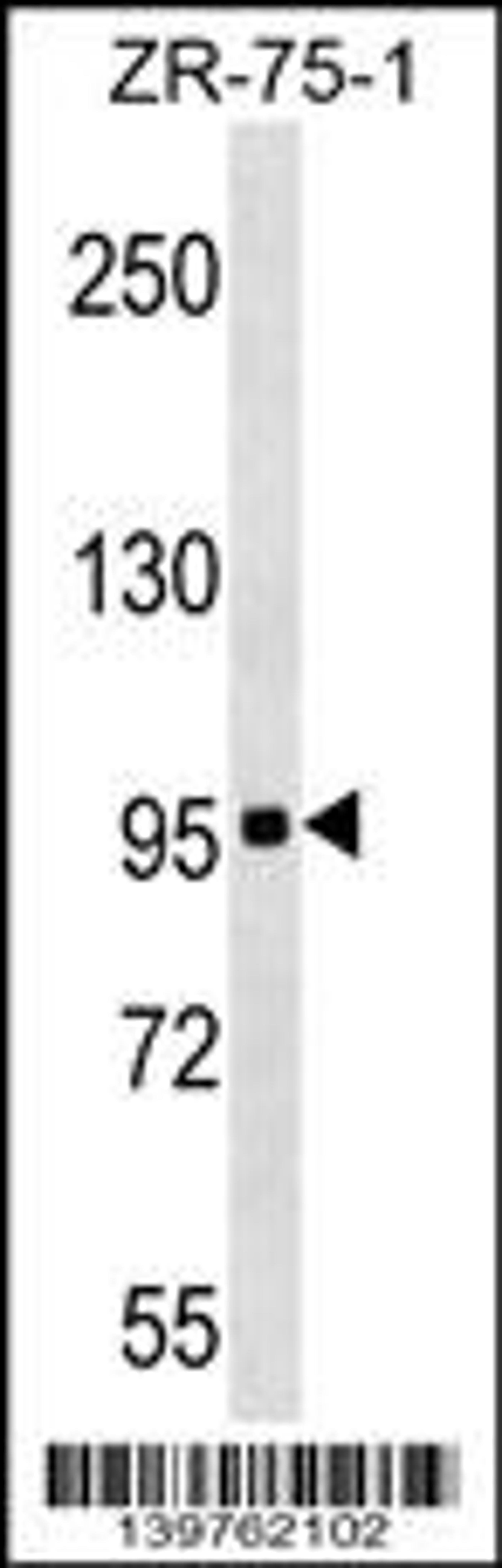 Western blot analysis in ZR-75-1 cell line lysates (35ug/lane).