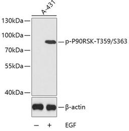 Western blot - Phospho-P90RSK-T359/S363 antibody (AP0539)