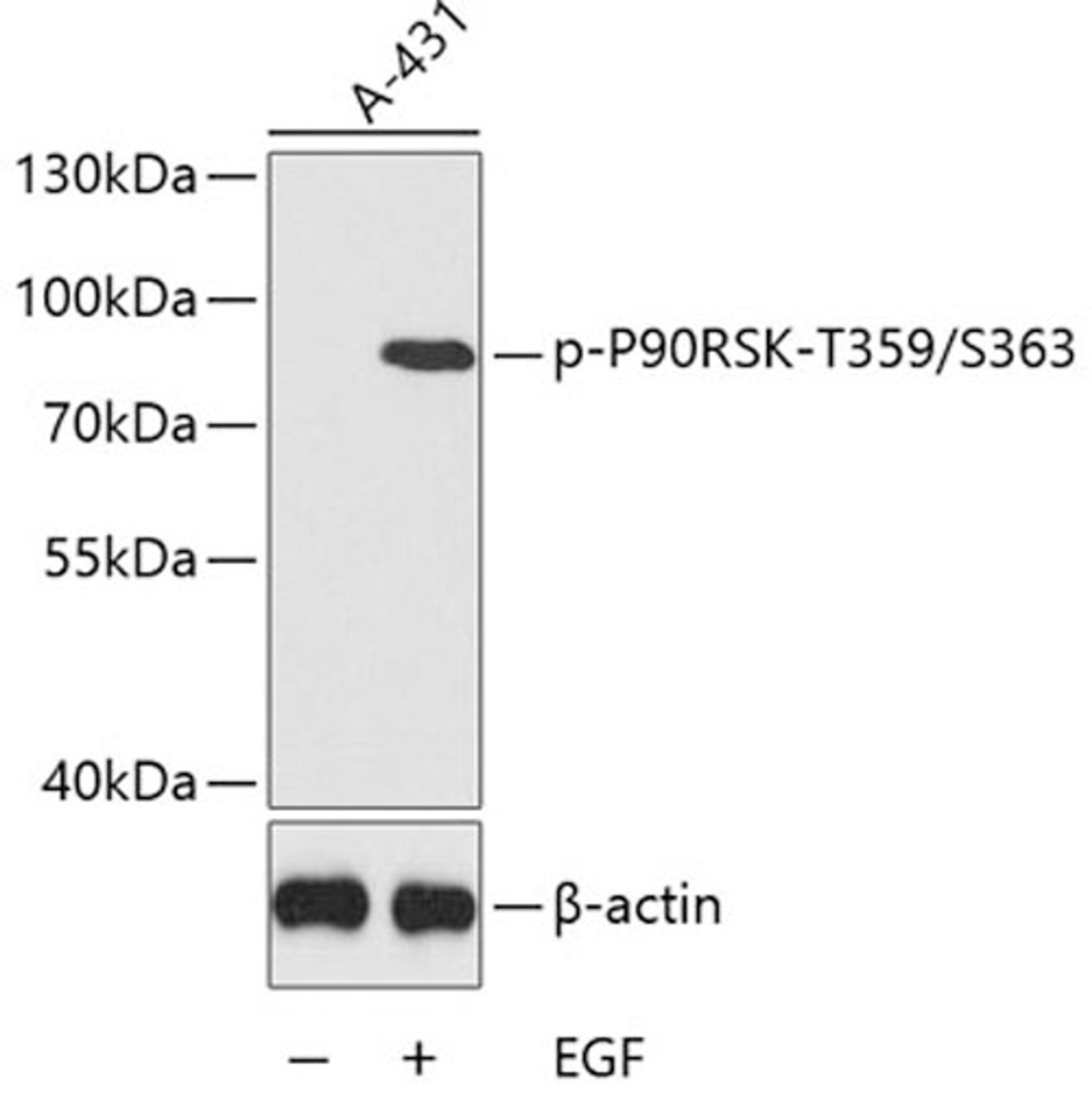 Western blot - Phospho-P90RSK-T359/S363 antibody (AP0539)