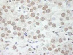 Immunohistochemistry-Paraffin: DDX17 Antibody [NB200-352] - FFPE section of human seminoma.  Affinity purified rabbit anti-DDX17 used at a dilution of 1:500.  Detection: DAB staining using Immunohistochemistry Accessory Kit