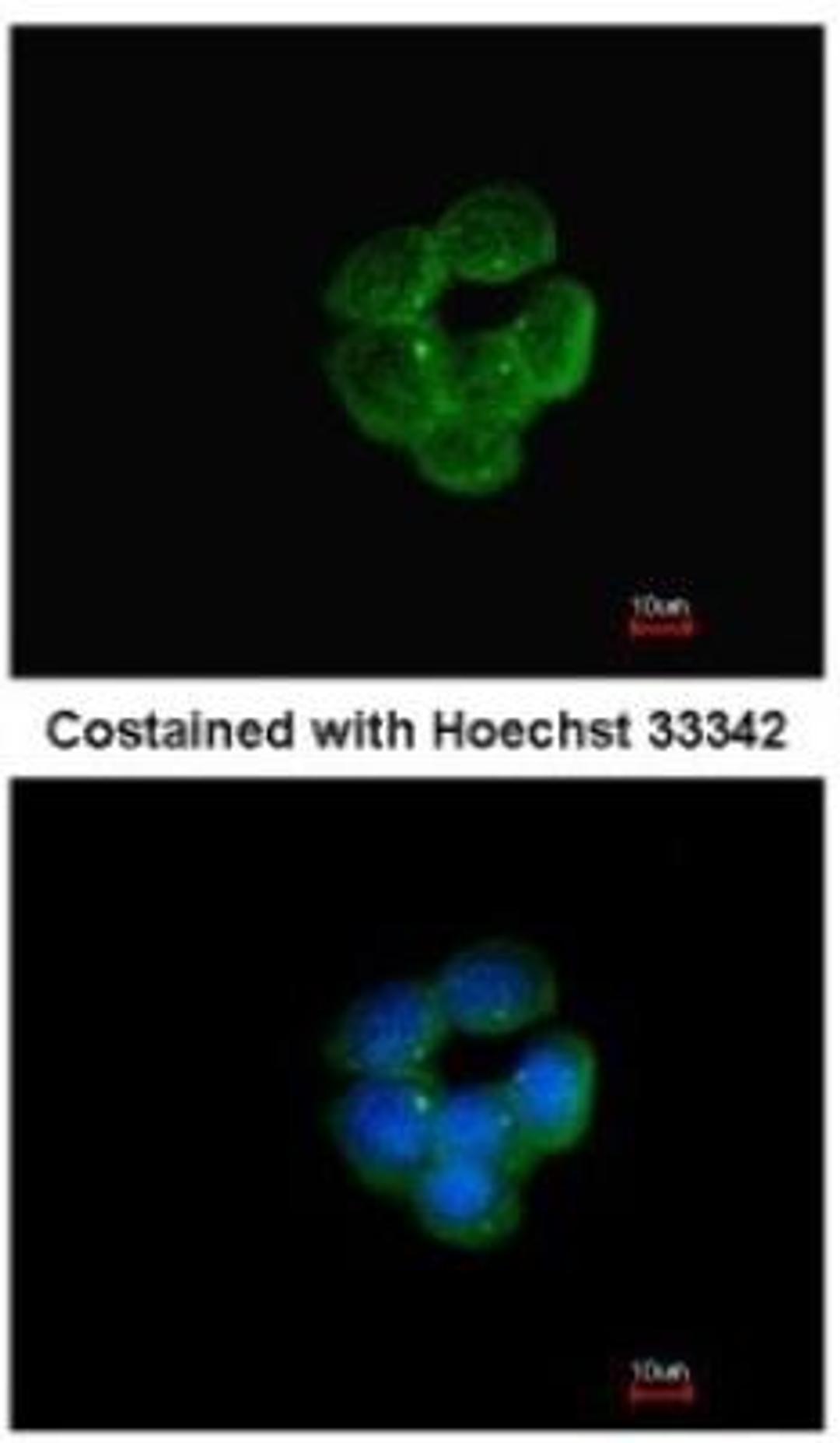 Immunocytochemistry/Immunofluorescence: NNT Antibody [NBP1-32109] - Analysis of methanol-fixed A431, using antibody at 1:200 dilution.