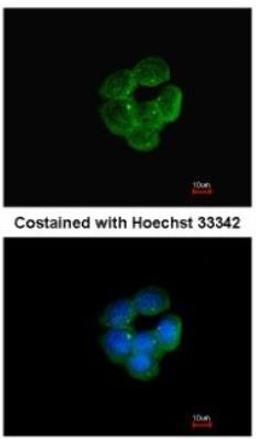 Immunocytochemistry/Immunofluorescence: NNT Antibody [NBP1-32109] - Analysis of methanol-fixed A431, using antibody at 1:200 dilution.