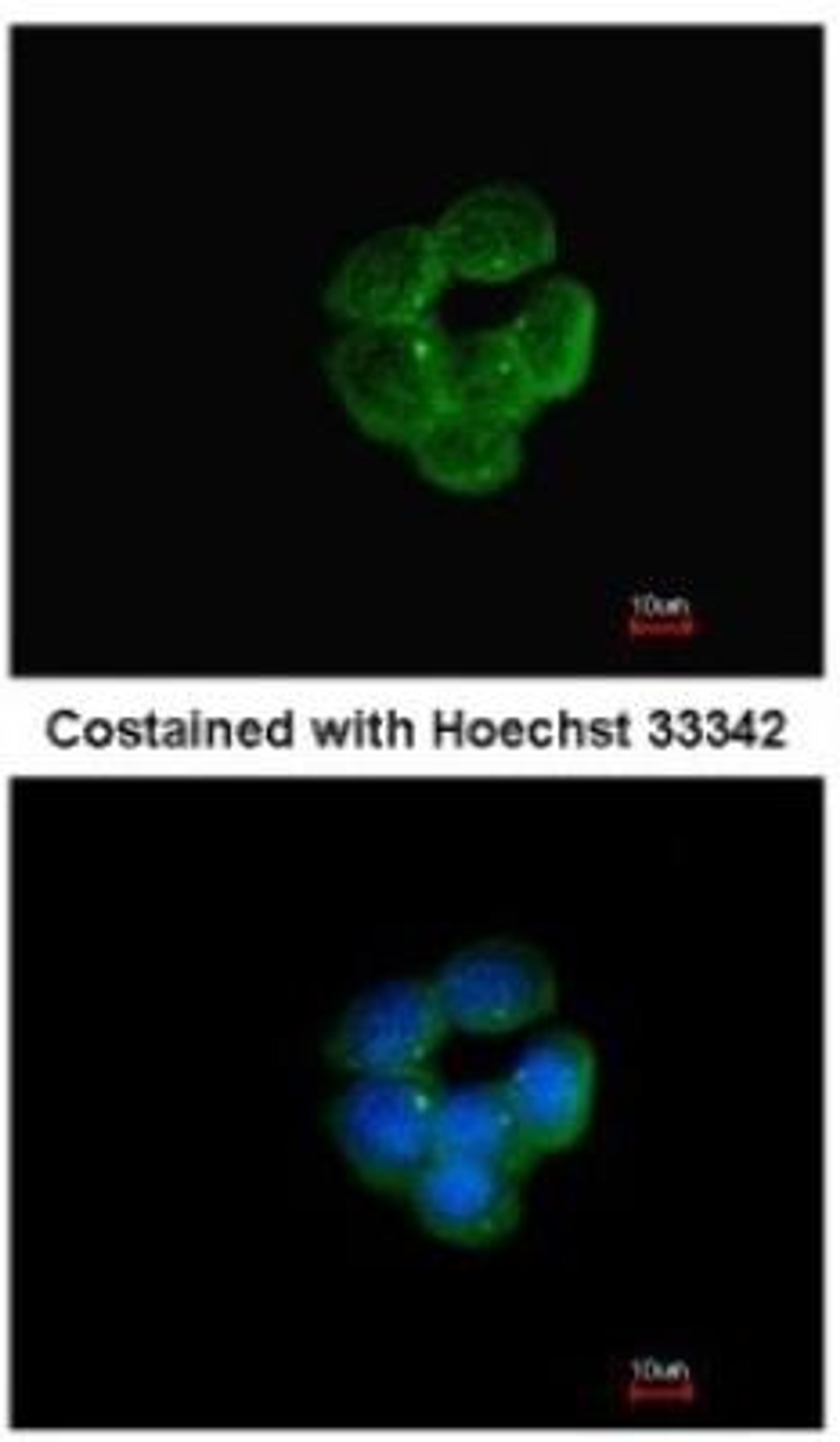 Immunocytochemistry/Immunofluorescence: NNT Antibody [NBP1-32109] - Analysis of methanol-fixed A431, using antibody at 1:200 dilution.