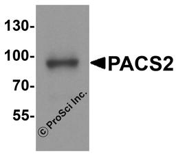 Western blot analysis of PACS2 in mouse brain tissue lysate with PACS2 antibody at 1 μg/ml.