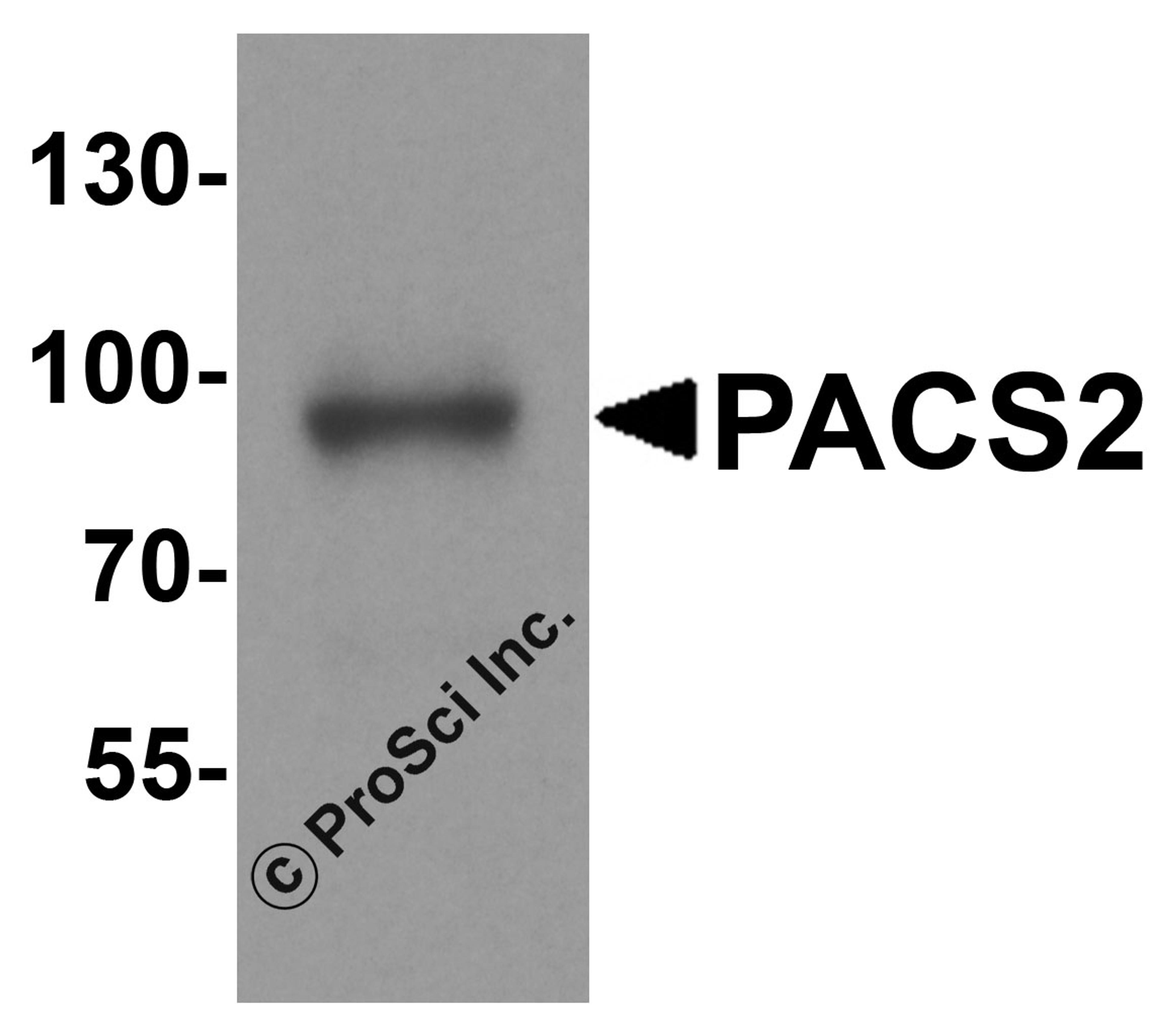 Western blot analysis of PACS2 in mouse brain tissue lysate with PACS2 antibody at 1 μg/ml.