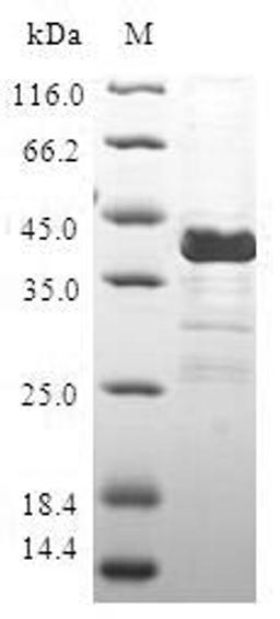 (Tris-Glycine gel) Discontinuous SDS-PAGE (reduced) with 5% enrichment gel and 15% separation gel.