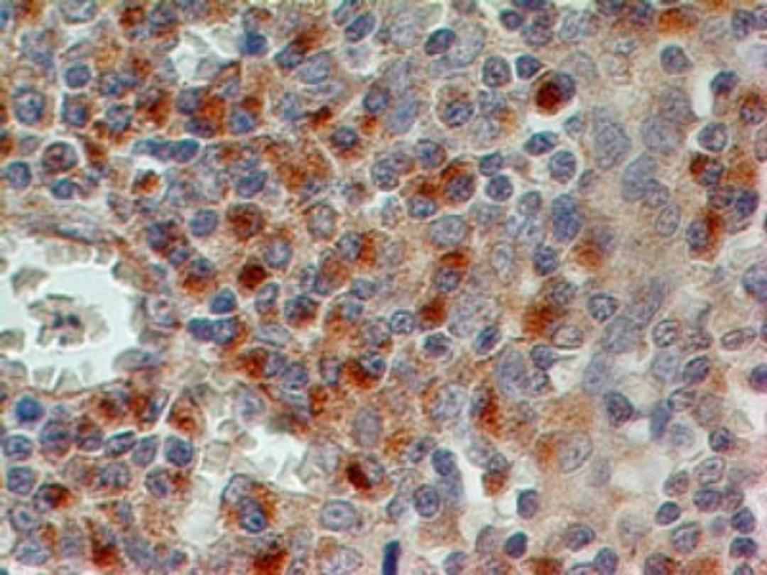 Immunohistochemistry-Paraffin: CD69 Antibody (15B5G2) [NBP2-25236] - Formalin-fixed, paraffin-embedded human tonsil stained with CD69 antibody (1 ug/ml), peroxidase-conjugate and DAB chromogen.