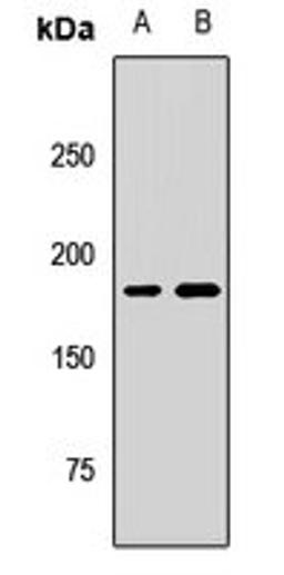 Western blot analysis of Hela (Lane1), HL60 (Lane2) whole cell lysates using KIF14 antibody