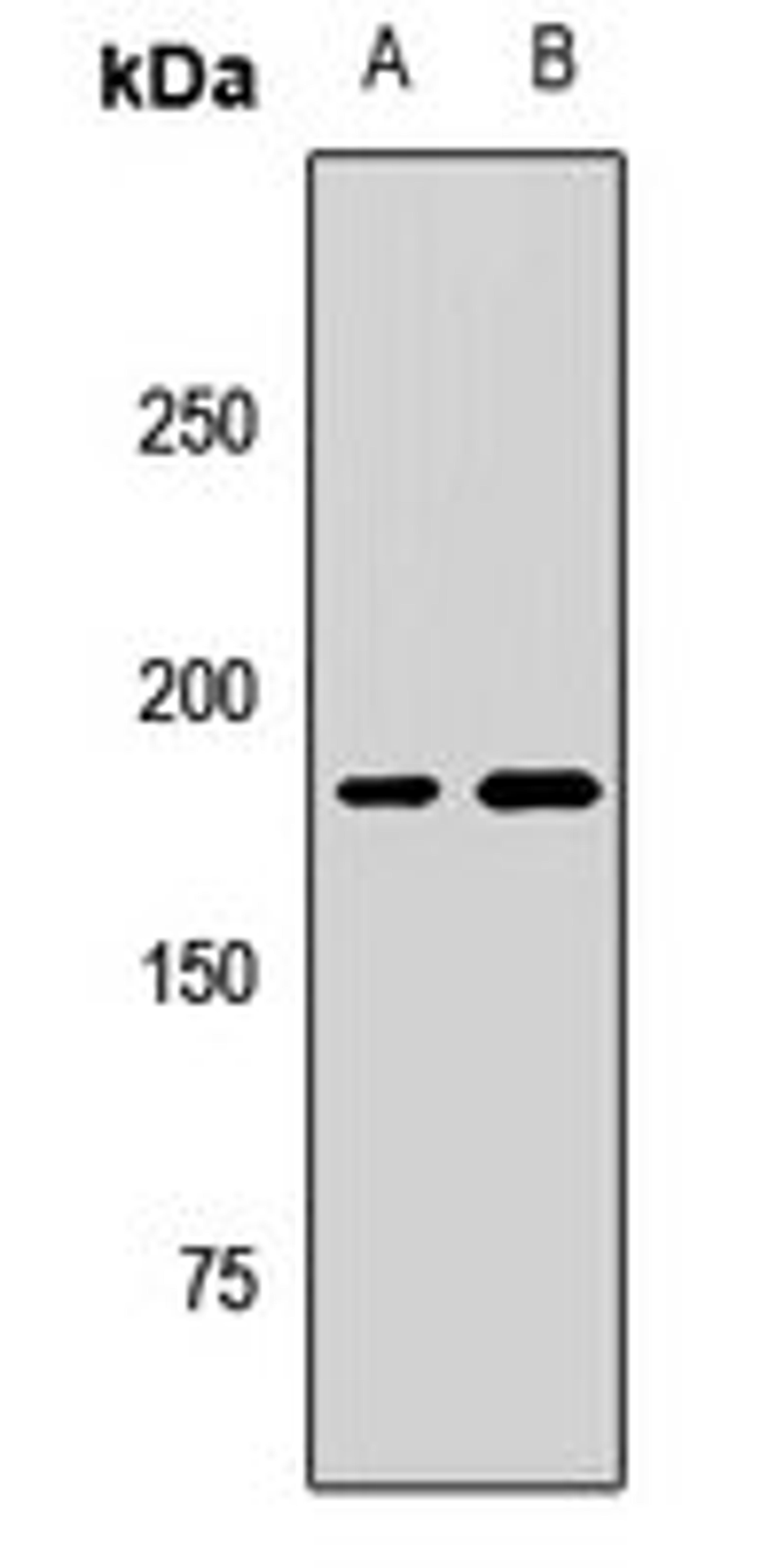 Western blot analysis of Hela (Lane1), HL60 (Lane2) whole cell lysates using KIF14 antibody