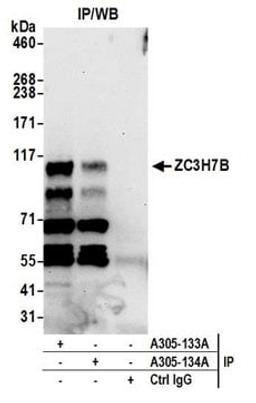 Detection of human ZC3H7B by western blot of immunoprecipitates.