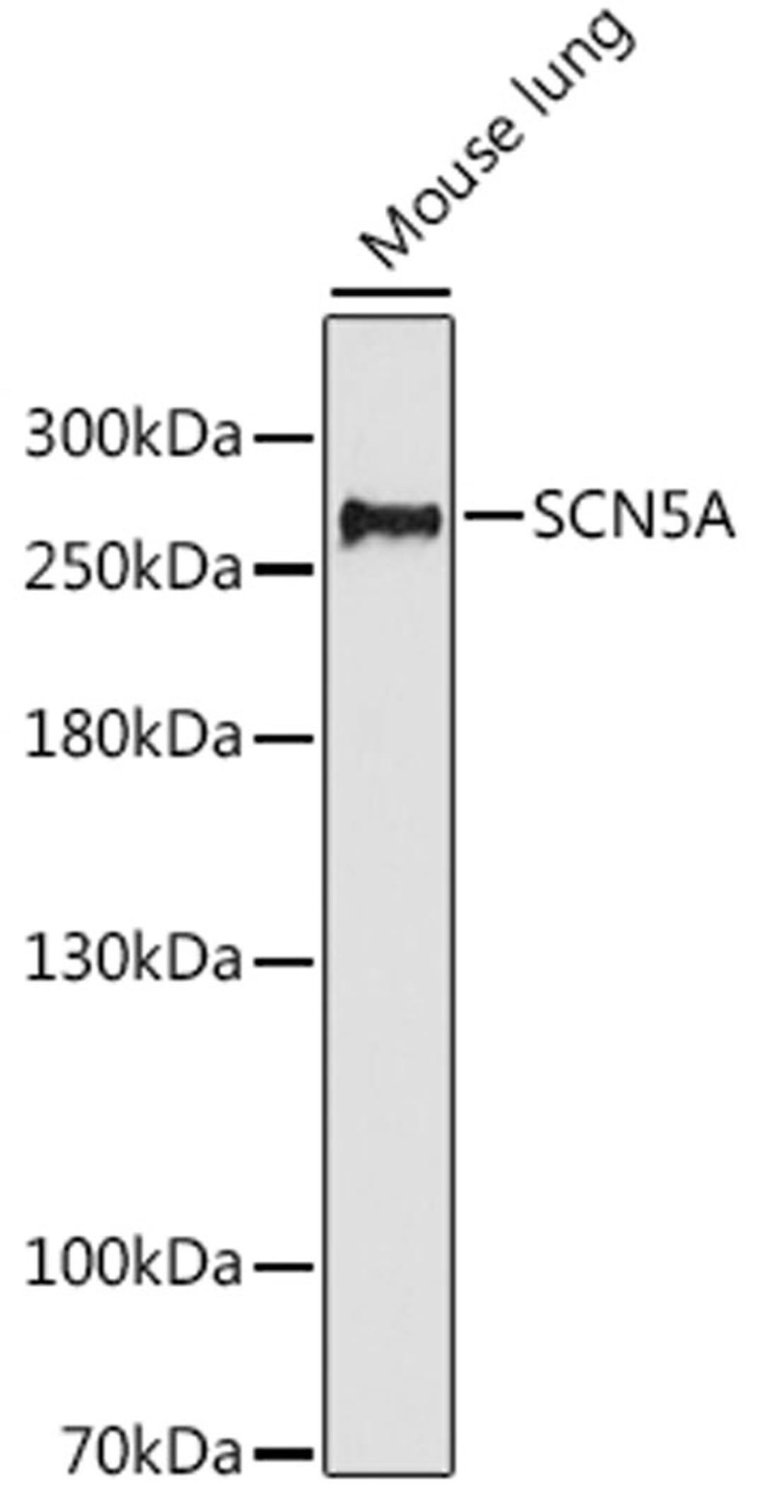 Western blot - SCN5A antibody (A16665)