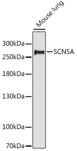 Western blot - SCN5A antibody (A16665)