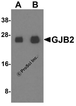 Western blot analysis of GJB2 in human colon tissue lysate with GJB2 antibody at (A) 1 and (B) 2 μg/ml.