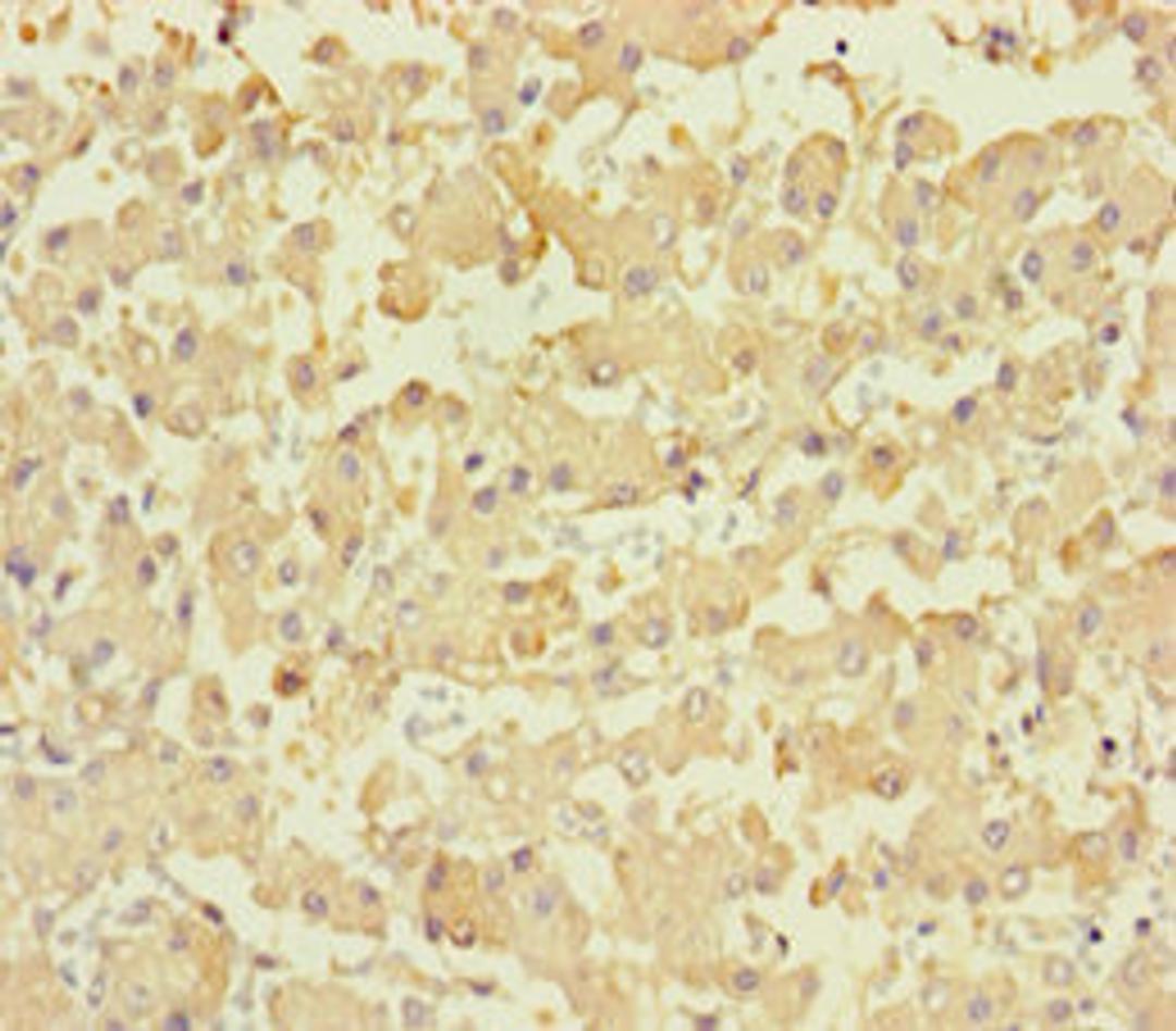 Immunohistochemistry of paraffin-embedded human liver tissue using CSB-PA836219HA01HU at dilution of 1:100