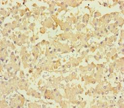 Immunohistochemistry of paraffin-embedded human liver tissue using CSB-PA836219HA01HU at dilution of 1:100