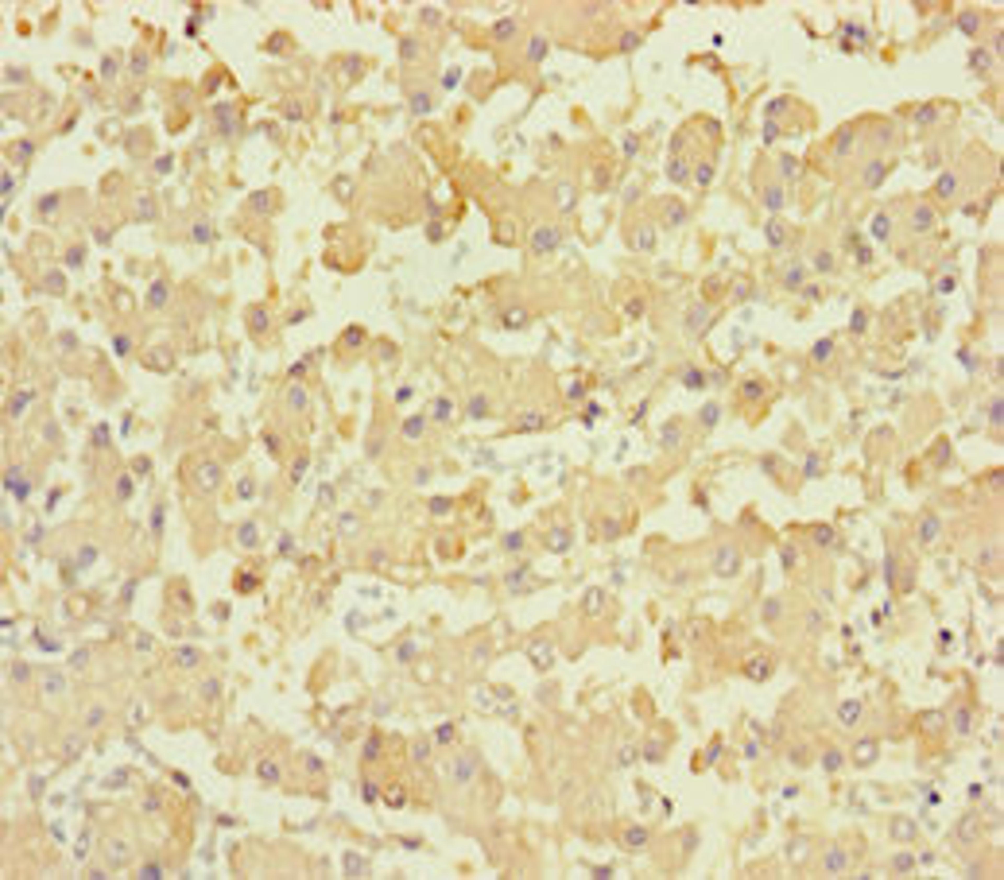 Immunohistochemistry of paraffin-embedded human liver tissue using CSB-PA836219HA01HU at dilution of 1:100