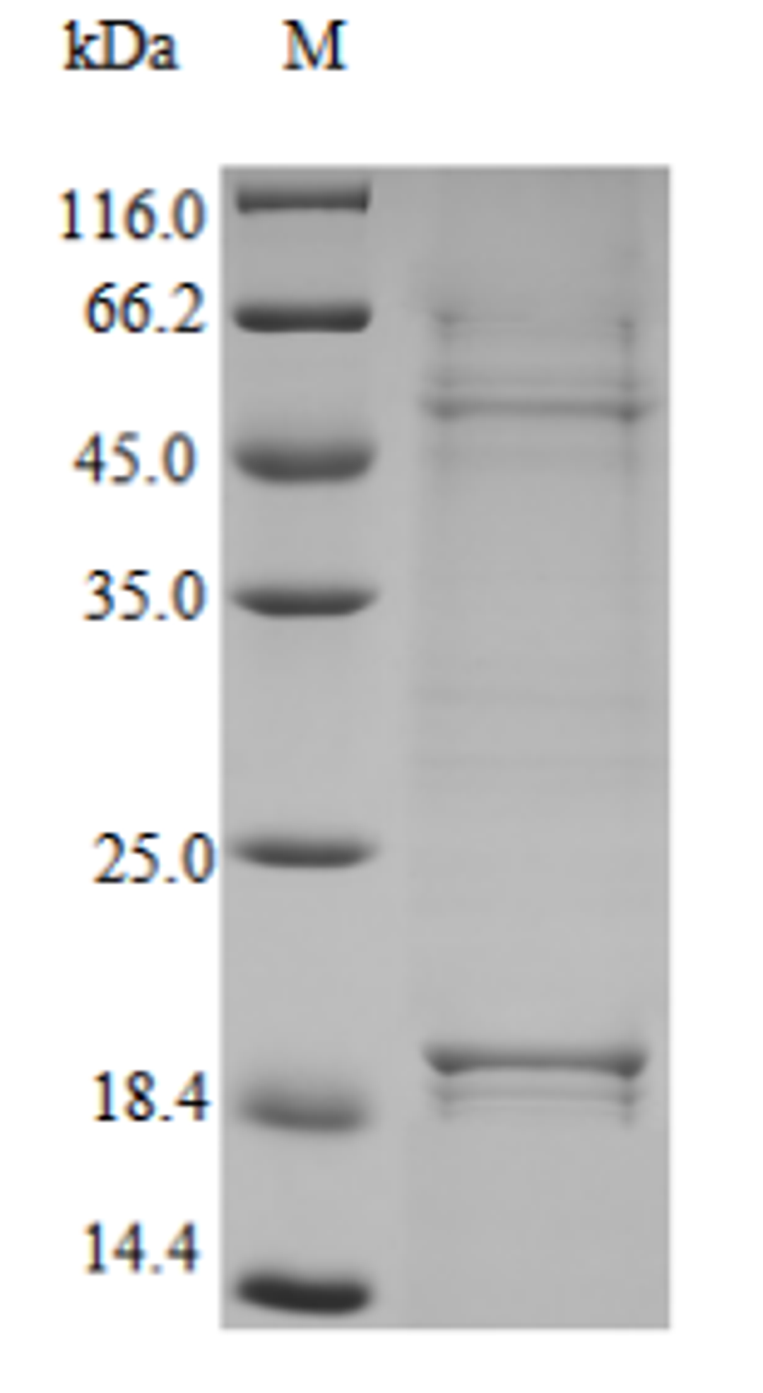 (Tris-Glycine gel) Discontinuous SDS-PAGE (reduced) with 5% enrichment gel and 15% separation gel.