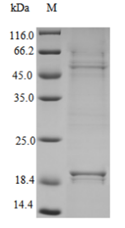 (Tris-Glycine gel) Discontinuous SDS-PAGE (reduced) with 5% enrichment gel and 15% separation gel.