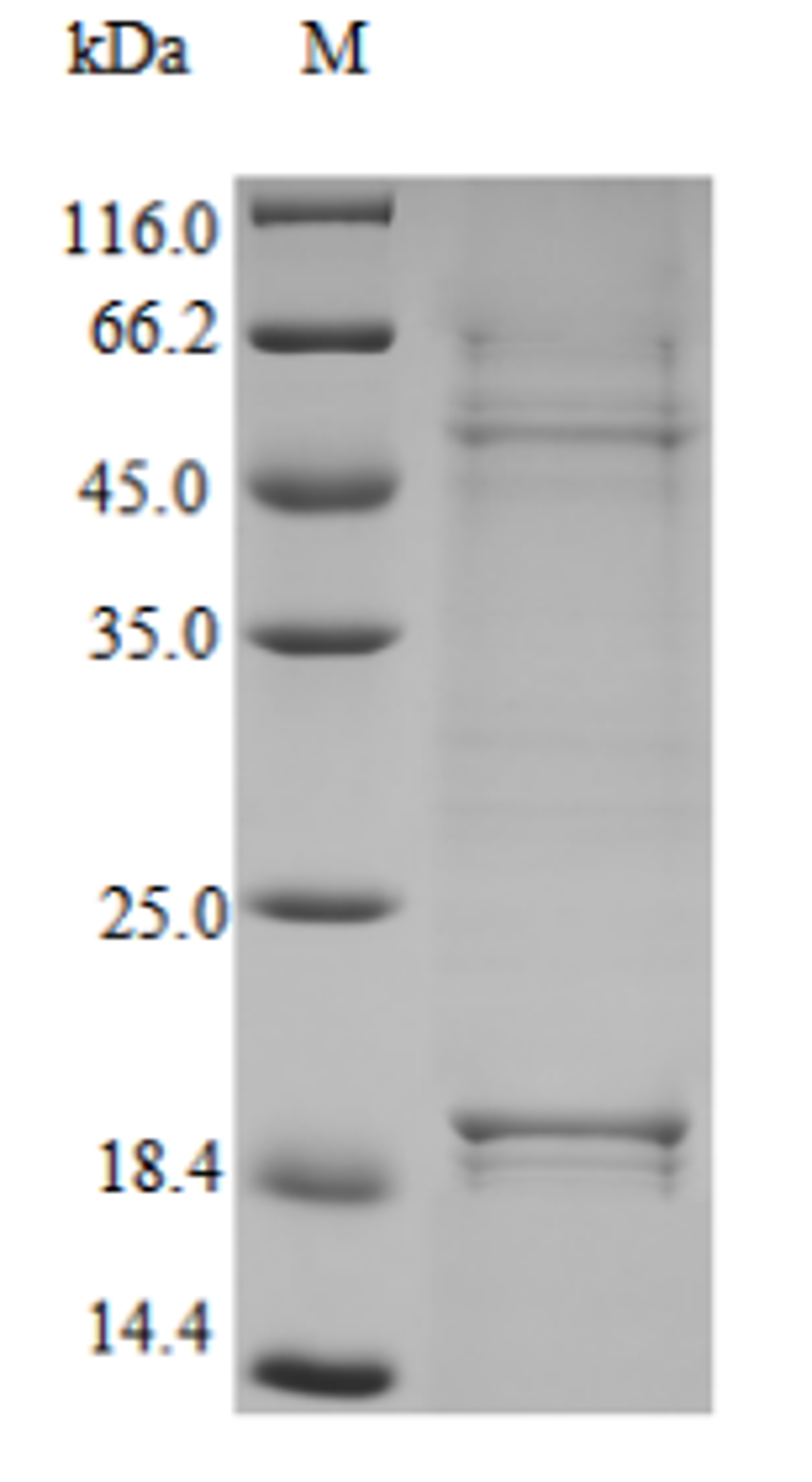 (Tris-Glycine gel) Discontinuous SDS-PAGE (reduced) with 5% enrichment gel and 15% separation gel.